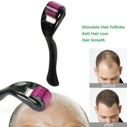 FitShop™ Derma Roller- For Hair Growth and Facial Skin Therapy